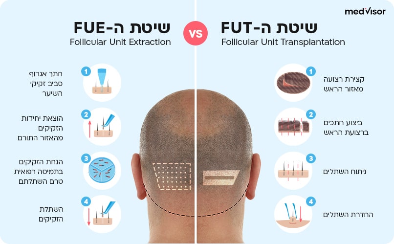 השוואה בין FUE לבין FUT