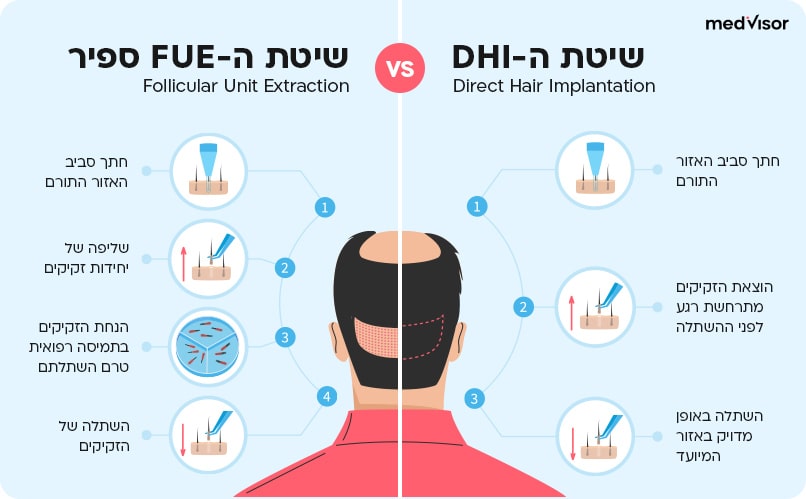 השוואה בין FUE לבין DHI